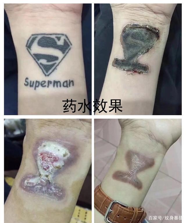 嘉兴哪个地方可以洗纹身(嘉兴哪个地方可以洗纹身的)